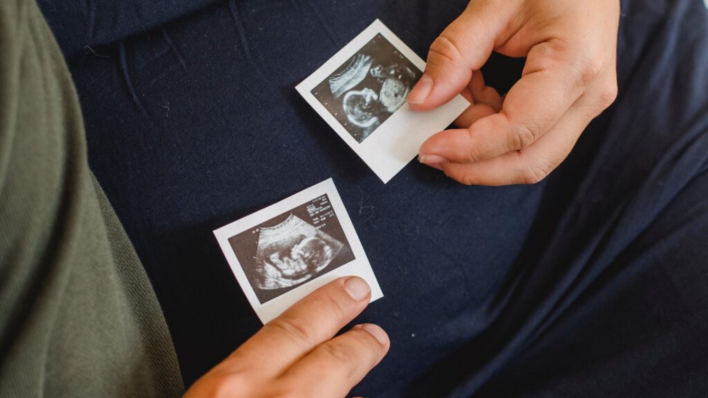 Trombofilia și fertilitatea la femei